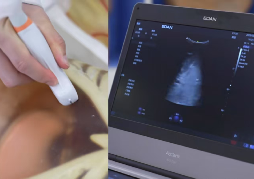 综合超声检查平台3.0